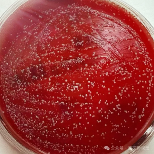 医用耦合剂开封后有效期几天？90%医护不知道的4个变质信号！ ...